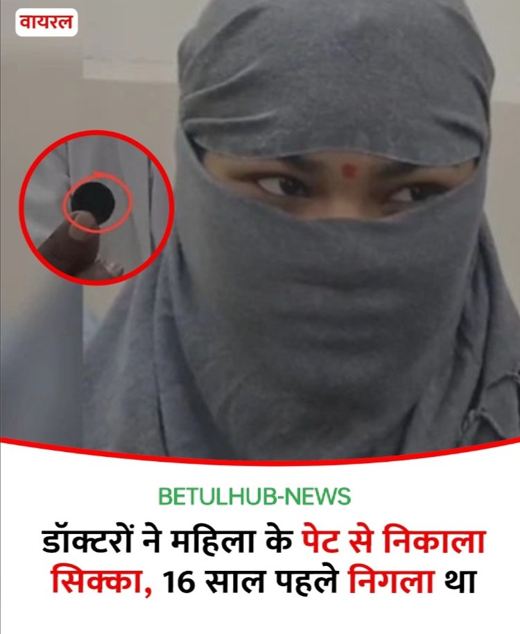 Doctors Remove Coin from Woman’s Stomach After 16 Years – BETULHUB News