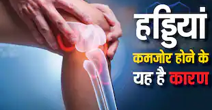 इन आदतों से कमजोर हो रही हैं आपकी हड्डियां, तुरंत करें सुधार