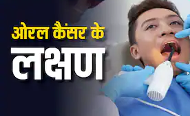 अगर दिखें ये 4 संकेत, तो हो सकता है ओरल कैंसर – जानिए लक्षण, कारण और बचाव