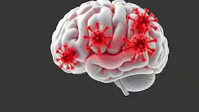 ब्रेन इंफेक्शन: तेज बुखार से लेकर बेहोशी तक, जानें दिमाग में इंफेक्शन के लक्षण, कारण और बचाव के उपाय